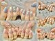 ミラクルネイル(Miracle Nail)の写真