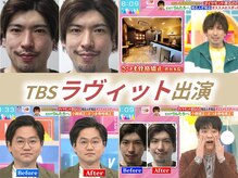 さつま骨格矯正 表参道青山院/TBS：ラヴィット生出演