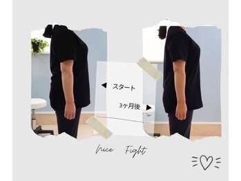 ティアラ/before after