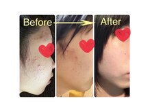 ヨサパーク ミルレ(YOSAPARK Milure)の雰囲気(水素+酸素吸引で美肌、リフトアップを叶える!)