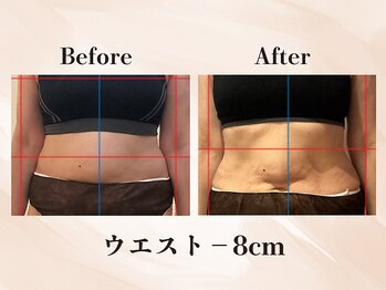 ビューティーエディットラボ(Beauty Edit Lab)の写真/【よもぎ蒸し×痩身エステ】温めて流すから結果が違う、本気の温活ダイエット♪
