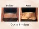 ビューティーエディットラボ(Beauty Edit Lab)の写真/【よもぎ蒸し×痩身エステ】温めて流すから結果が違う、本気の温活ダイエット♪