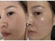 ナチュラ ソース(NatureSouce)の写真/話題の韓国くすみケアをお得に体験！毛穴を整え水光肌とツヤ感、うるおいを叶える癒やしのひと時☆