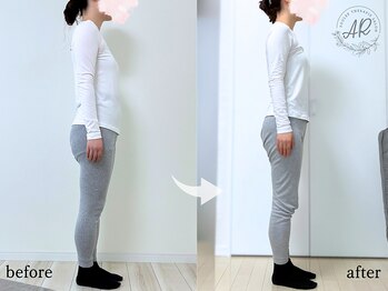 エーアール 白金高輪(AR)の写真/＼女性専用・骨を整えるから全部かなう！／肩こり・腰痛・スタイル改善★カラダのお悩みお任せください♪