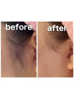 お肌をきれいにしたい