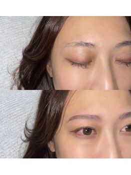 グレーシェル 天神大名店(Gracher)/HBL Before→After