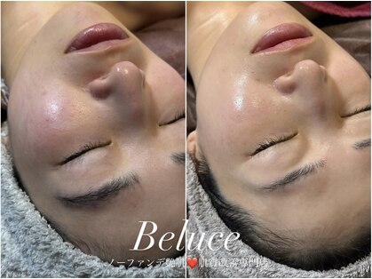 ベルーチェ(Beluce)の写真