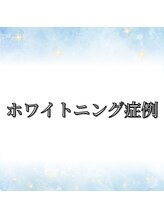ブリリアント 京都店(Brilliant)/ホワイトニングの症例