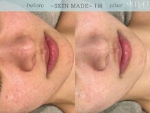 スキンラボアメリ(skin lab. ameri)/お悩み…ゆらぎ肌 赤み