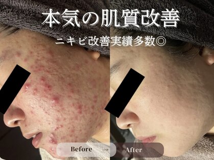 ルノン 天神店(LUNON)の写真