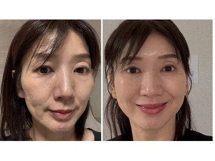 セル ノ ネ(Cell ne)の写真