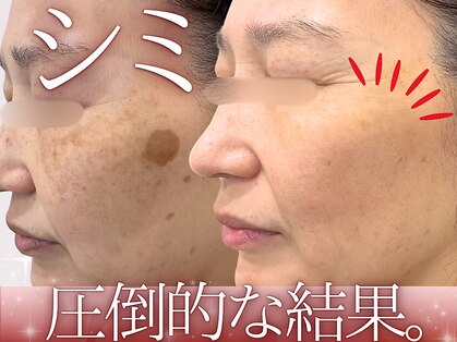 ハウオリ(HAUOLI)の写真