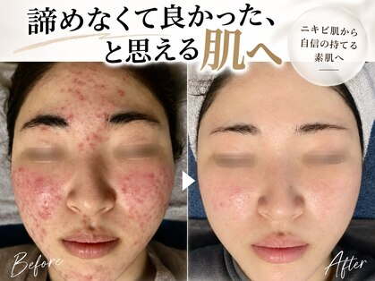 リリアス(RILLIAS)の写真