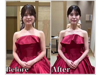 整体ラルース 中目黒(LALUZ)/20代 女性 ブライダル整体 変化