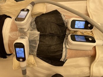 ローザー トウキョウ(Lowther Tokyo)/脂肪冷却４カップ例