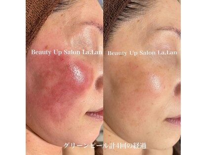 ララン La.Lanの写真