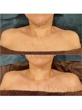 プライベートサロン ルクサージュ(Luxeage)/フェイスケアには欠かせません☆