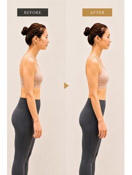 ライフ ピラティス スタジオ(LIFE Pilates Studio)の写真/スマホ首・ストレートネックは『首』ではなく【肋骨】から変える