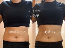 リノレア(Lino_Lea)/【痩身ダイエット】