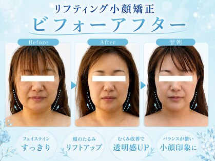 アールフェイスバランスの写真