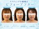 アールフェイスバランスの写真