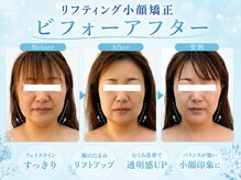 アールフェイスバランス