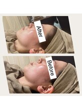 サロン ド チェリー 西町店(Salon de Cherry)/光フォト