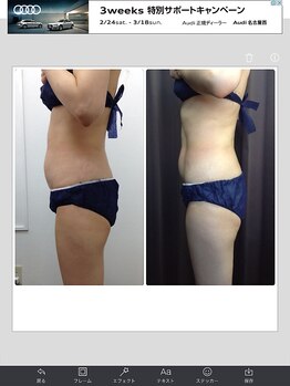 健康痩身研究所 蟹江店/ビフォーアフター