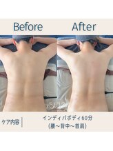 スー(Sue)/ボディ60分before→after