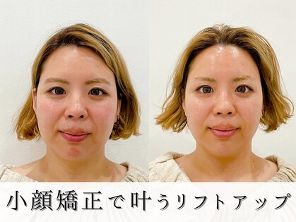 ジョンミー(JONMEE)の写真