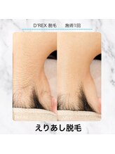 エクラ 六本木(eclat)/最新ハイブリッド脱毛