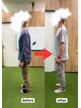 ネーム鍼灸整骨院 春日 本郷三丁目院/腰痛でお悩みだったTさん