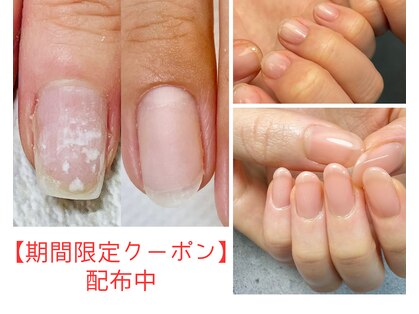 ネイルサロン ミノアッカ(mino'aka)の写真