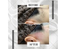 バロックビューティーラウンジ(BAROQ beauty lounge)/最新光脱毛