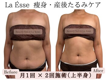 ラエッセ(La Esse)/産後ケア&姿勢改善へ