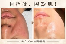 ユキエル(yukielle)