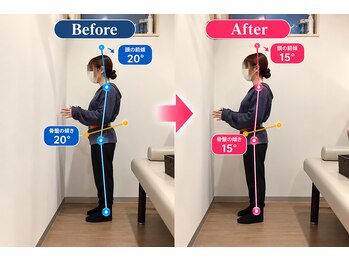 北越谷しんあい整骨院の写真/専用ベットでの矯正整体で長年の歪み・姿勢を改善！通常価格より66%OFF！￥4,500→2,900