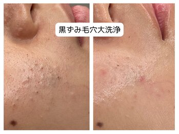 アロマ(AROMA)/《深い凹凸ケア》(2)