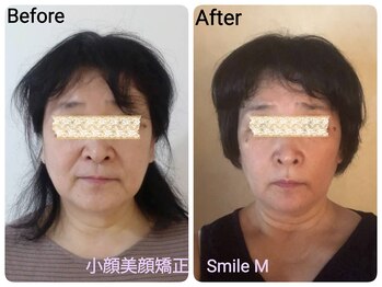 スマイルエム(SmileM)/