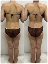 シャルム(Charme)/before・after