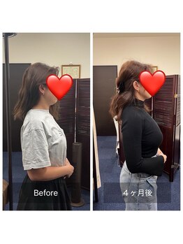 ティアラ/before after