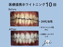 セイ(sei)/症例写真　ビフォーアフター