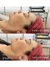 ルビーミー(Ruby's Me)/