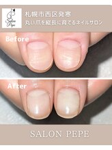サロンペペ(salon pepe)/自爪育成で育てた親指