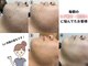ジェントル 福岡天神店(GENTLE)の写真/【第一印象が変わるヒゲ脱毛】青&濃ヒゲを改善♪朝の忙しい時間に髭剃りがめんどくさい!荒れるという方へ
