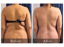 TOTAL BEAUTY SALON LUMORAの雰囲気（よもぎ蒸し,リンパケア,ハイパーナイフでスッキリボディへ）