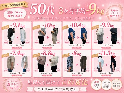ヴェリテ(Verite)の写真