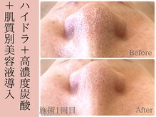 マシェリ 吉祥寺(Macherie)