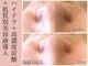 マシェリ 吉祥寺(Macherie)の写真