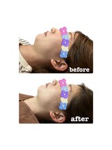 ピエール ナリタイラボ 久留米店(Piel NARITAI LABO)/凄い！肌トーンUP